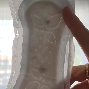 Molped Günlük Pedlerde Kahverengi Lekeler Ve Güven Sorunu