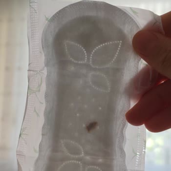 Molped Günlük Pedlerde Kahverengi Lekeler Ve Güven Sorunu