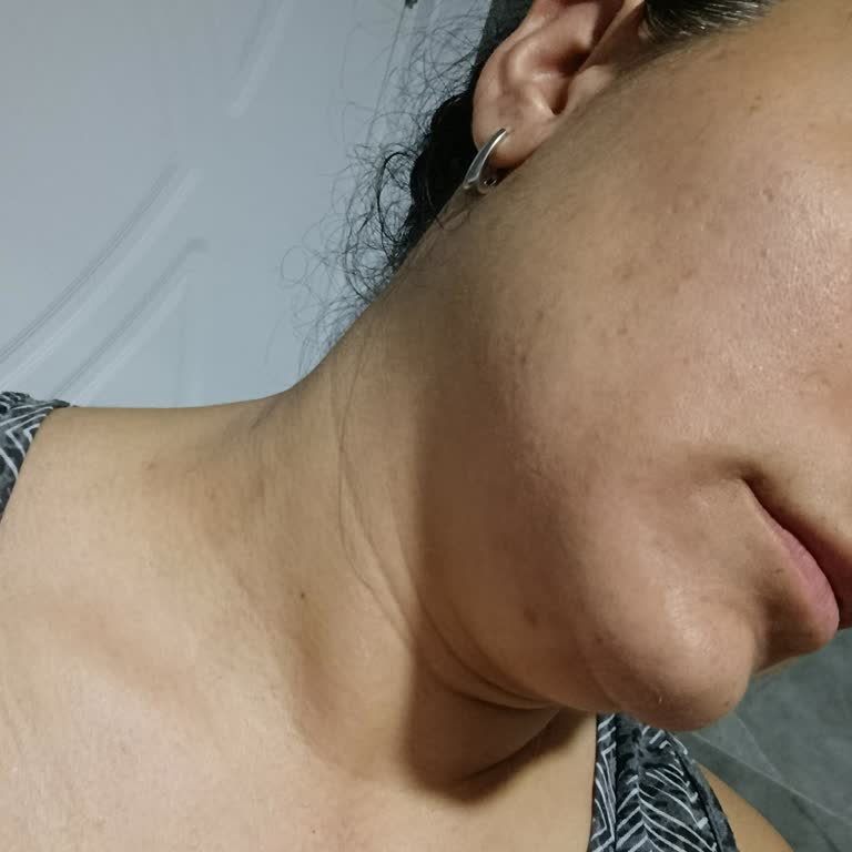 Ürün Kullanımı Sonrası Cilt Sorunları Yaşadım