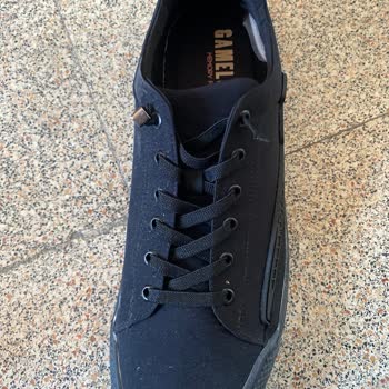 Aldığım Ayakkabı Ayağımda Yaralara Sebep Oldu