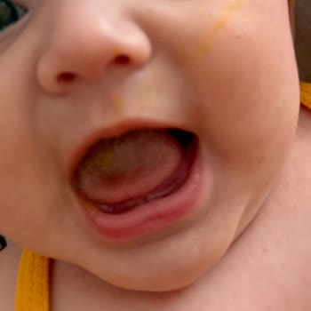 Wee Baby Diş Kaşıyıcı Kısa Sürede Su Sızdırdı Ve Bebeğimin Yüzünde Leke Oluştu