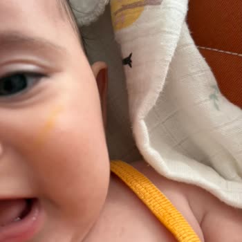 Wee Baby Diş Kaşıyıcı Kısa Sürede Su Sızdırdı Ve Bebeğimin Yüzünde Leke Oluştu