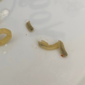 Aldığım Paketlerde Yabancı Maddeler Ve Böceklerle Karşılaştım, Müşteri Hizmetlerine Ulaşamıyorum