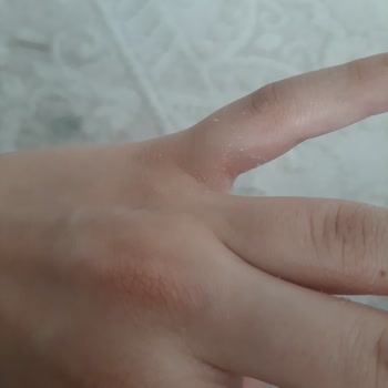 Activex Sıvı Sabun Ellerimi Tahriş Etti