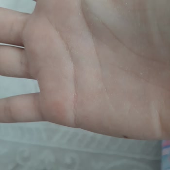 Activex Sıvı Sabun Ellerimi Tahriş Etti