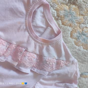 Arçelik Çamaşır Makinesi Temizleme Sorunu Ve Çözüm Eksikliği