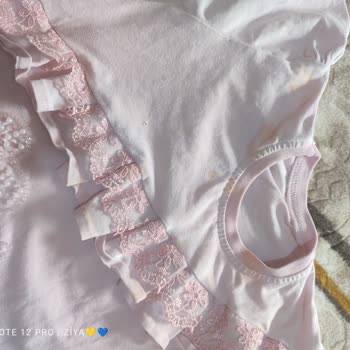 Arçelik Çamaşır Makinesi Temizleme Sorunu Ve Çözüm Eksikliği