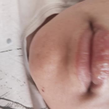 Acil Serviste Yanlış Tedavi Sonrası Sağlık Sorunları Yaşadık