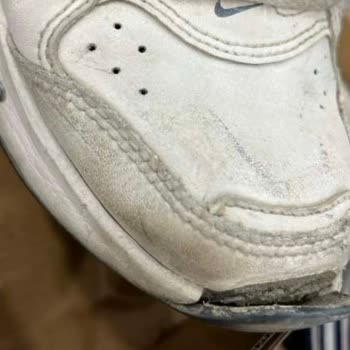 Ayakkabının Arka Kısmındaki Demirlerin Çıkması Ve Çözüm Sürecinde Yaşananlar