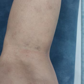 Aldığım Tedaviden Sonuç Alamadım Beklediğim Faydayı Göremedim