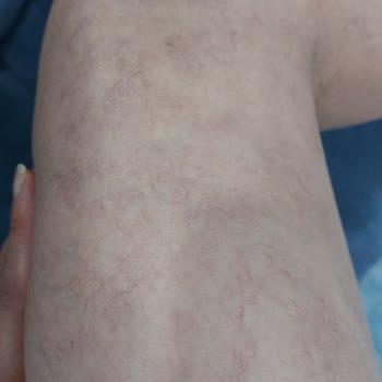 Aldığım Tedaviden Sonuç Alamadım Beklediğim Faydayı Göremedim