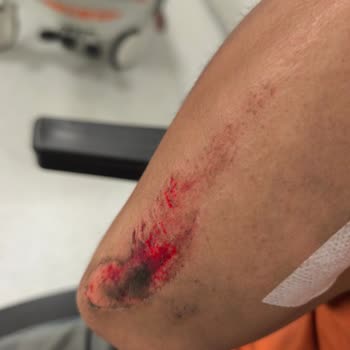 Motolux Sıfır Alınan Motolüx CEO 110'da Fren Arızası Sonucu Kaza Ve Mağduriyet!