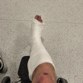 Motolux Sıfır Alınan Motolüx CEO 110'da Fren Arızası Sonucu Kaza Ve Mağduriyet!