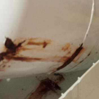 Aura Cebilon Garanti Süresi Hakkında Bilgilendirme Eksikliği Ve Su Tankı Değişimi Talebi