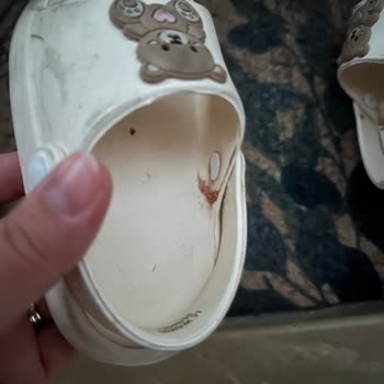 Çocuğumun Ayağını Yaralayan Kalitesiz Terlik