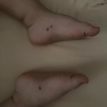 Çocuğumun Ayağını Yaralayan Kalitesiz Terlik