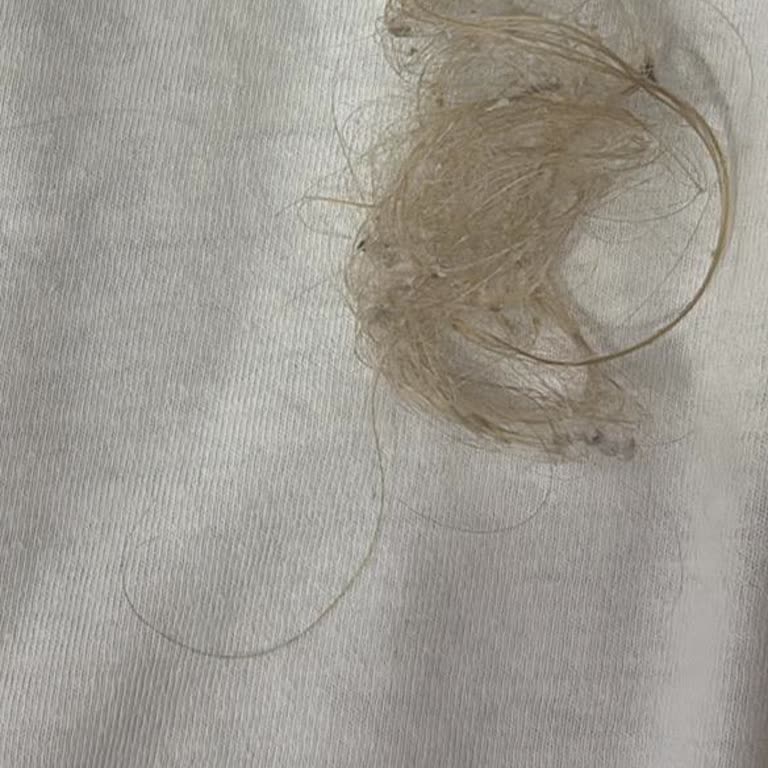 Yves Rocher Şampuan Saç Dökülmesine Sebep Oldu