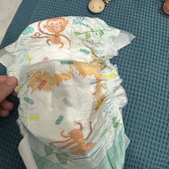 Prima Bebek Bezinde Boyalı Ve Sert Ürün Şoku
