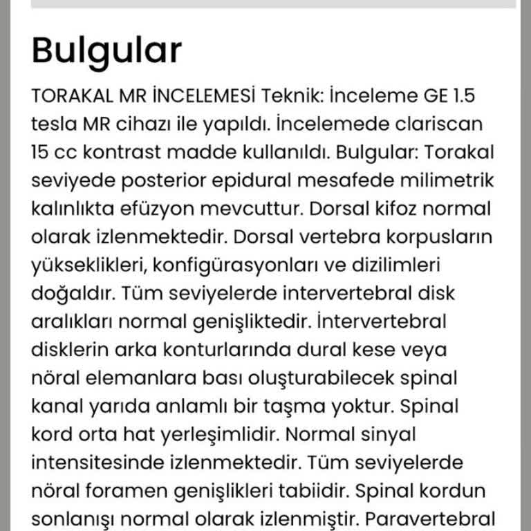 Medicana Sağlık Grubu Yetersiz Bilgilendirme Ve Yüksek Ücret Sonrası Sonuçsuz Tedavi!