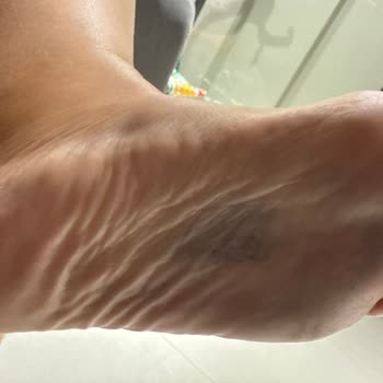 Aldığım Terlik Ayağımı Boyuyor, Çözüm Sunulmadı