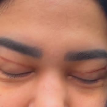 Sahte Doktor Nedeniyle Yaşadığım Mağduriyet Ve Psikolojik Sıkıntı