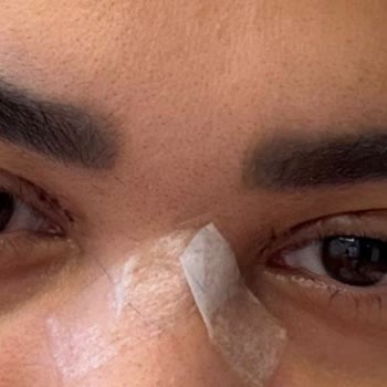Sahte Doktor Nedeniyle Yaşadığım Mağduriyet Ve Psikolojik Sıkıntı