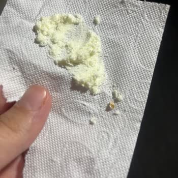 Mama İçinden Yabancı Madde Çıkması Ve Sağlık Sorunları