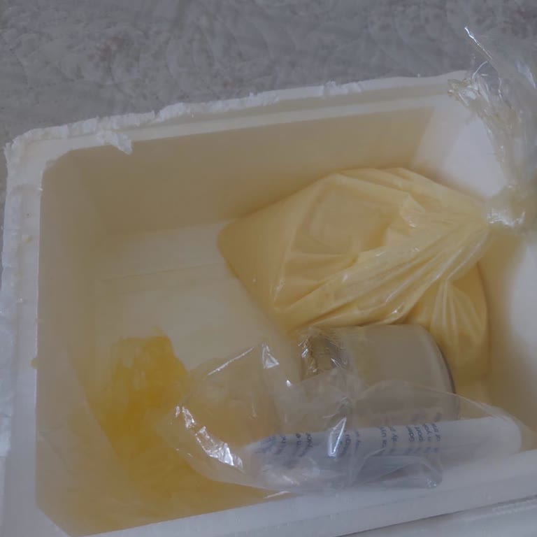 Erimiş Tereyağına Çözüm Yerine Geçici Öneri Ve Olumsuz Yorumların Silinmesi