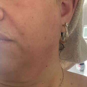 Yüz Yıkama Jeli Cildimde Yanma Ve Kızarıklık Yaptı, İade Talep Ediyorum