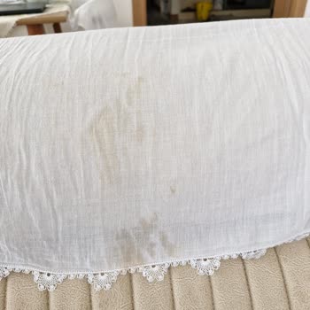 Tefal Ütüde Su Akıtma Ve Sarı Leke Sorunu Büyük Hayal Kırıklığı Yarattı