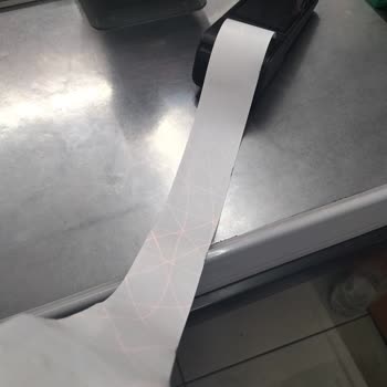 Beko POS Cihazındaki Sorunlar Ve Yetersiz Servis Desteği