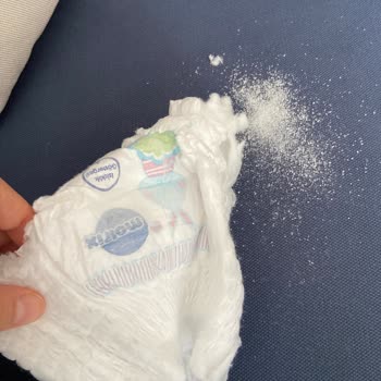 Molfix Bebek Bezinde Yabancı Madde Ve Sürekli Sorun Yaşanması