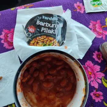 Yurdum Barbunya Pilaki İçinden Çıkan Sert Cisim Damağımı Yaraladı