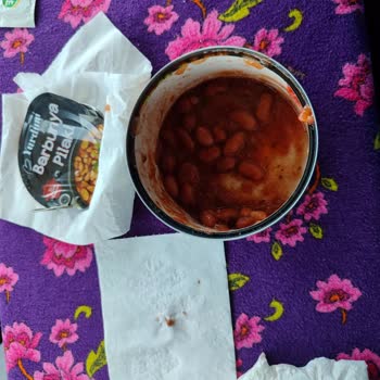 Yurdum Barbunya Pilaki İçinden Çıkan Sert Cisim Damağımı Yaraladı