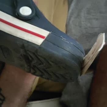 Benim Ayakkabıcım Terlikler Birleşme Yerinden Açıldı