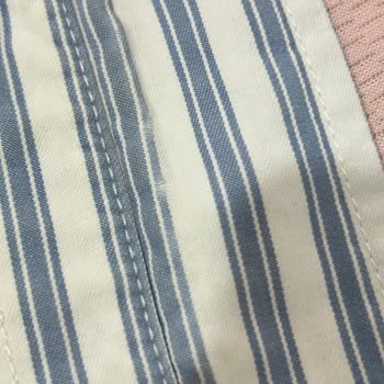 Mavi Gömlekte Yaka Bölgesinde Kumaş İncelmesi Ve Yırtık Oluşması