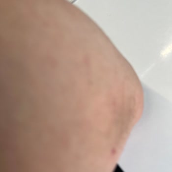 Yüksek Fiyat, Düşük Kalite: Beklentilerimin Çok Altında Bir Deneyim