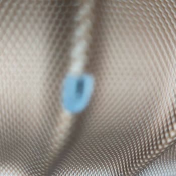 Pegasus'tan Valiz Hasarı Ve Yetersiz Çözüm: Müşteri Memnuniyeti Sıfır