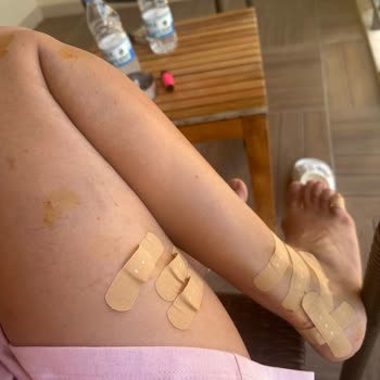 Crystal Hotels Ciddi Sorunlar Yaşama