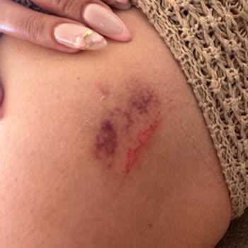 Crystal Hotels Ciddi Sorunlar Yaşama