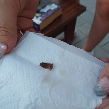 Otelin Hijyen Ve Hizmet Kalitesi Beklentilerin Çok Altında Kaldı