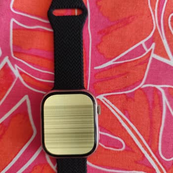 Garanti Sürecinde Çözülmeyen Akıllı Saat Sorunu Ve İlgisiz Müşteri Hizmeti