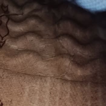 FLO'dan Alınan Ayakkabının Kusuru Ve Garanti Talebinin Haksız Reddi