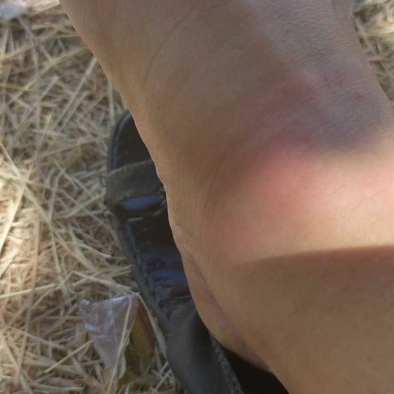 Lumberjack Sandalet Ayaklarımı Boyadı İade Talebim Reddedildi