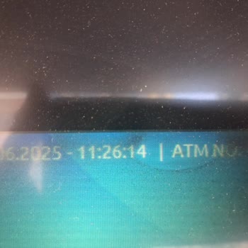 İş Bankası ATM Arızası Nedeniyle Eksik Para Yatırılması Ve Mağduriyet