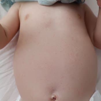 Bebek Ürününde Kızarıklık Ve Yağda Sorun Yaşadım, Para İadesi İstiyorum