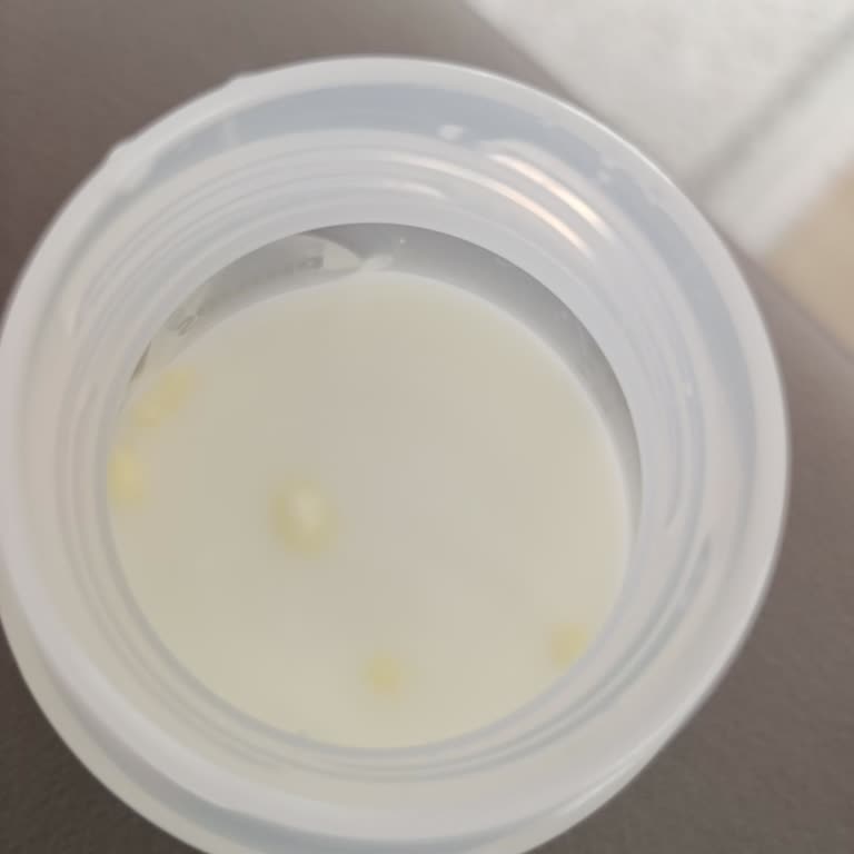 Conformil Mamada Topaklanma Sorunu Ve Sorumluluk Endişesi