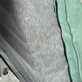 Bir Aydır Çözülemeyen Çamaşır Makinesi Sorunu Ve Yetersiz Servis Desteği