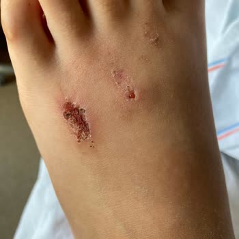 Aldığım Terlik Çocuğumun Ayağını Yaraladı, Mağaza Değişim İçin Yardımcı Olmuyor