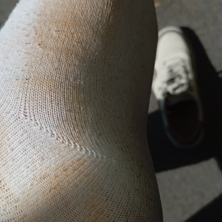 FLO Mağazasından Aldığım Ayakkabının Boyası Çoraplarımı Boyadı, Sorunum Çözülmedi